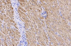 Invitrogen Alpha-Smooth Muscle Actin Polyclonal Antibody 100 &mu;L; Unconjugated:Antibodies,