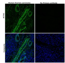 Invitrogen Alpha-Smooth Muscle Actin Polyclonal Antibody 100 &mu;L; Unconjugated:Antibodies,