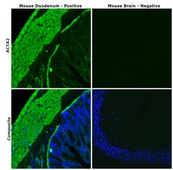 Invitrogen Alpha-Smooth Muscle Actin Polyclonal Antibody 100 &mu;L; Unconjugated:Antibodies,
