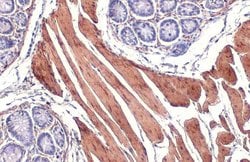 Invitrogen Alpha-Smooth Muscle Actin Polyclonal Antibody 100 &mu;L; Unconjugated:Antibodies,