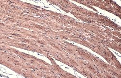 Invitrogen Alpha-Smooth Muscle Actin Polyclonal Antibody 100 &mu;L; Unconjugated:Antibodies,