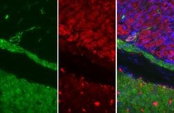 Invitrogen Alpha-Smooth Muscle Actin Polyclonal Antibody 100 &mu;L; Unconjugated:Antibodies,