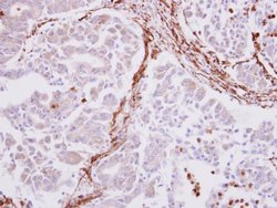 Invitrogen Alpha-Smooth Muscle Actin Polyclonal Antibody 100 &mu;L; Unconjugated:Antibodies,