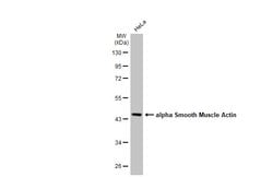 Invitrogen Alpha-Smooth Muscle Actin Polyclonal Antibody 100 &mu;L; Unconjugated:Antibodies,