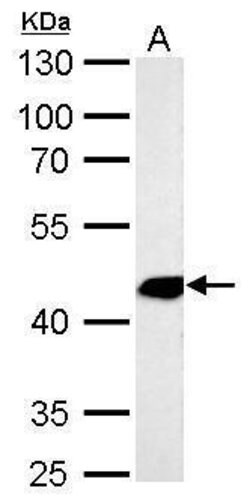 Invitrogen Alpha-Smooth Muscle Actin Polyclonal Antibody 100 &mu;L; Unconjugated:Antibodies,