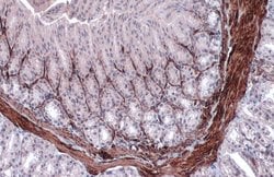 Invitrogen Alpha-Smooth Muscle Actin Polyclonal Antibody 100 &mu;L; Unconjugated:Antibodies,