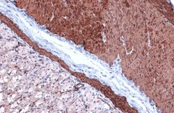 Invitrogen Alpha-Smooth Muscle Actin Polyclonal Antibody 100 &mu;L; Unconjugated:Antibodies,