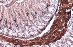 Invitrogen Alpha-Smooth Muscle Actin Polyclonal Antibody 100 &mu;L; Unconjugated:Antibodies,