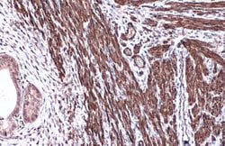 Invitrogen Alpha-Smooth Muscle Actin Polyclonal Antibody 100 &mu;L; Unconjugated:Antibodies,