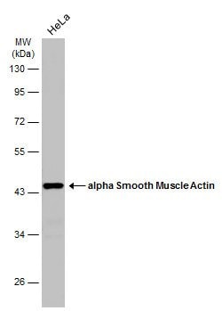 Invitrogen Alpha-Smooth Muscle Actin Polyclonal Antibody 100 &mu;L; Unconjugated:Antibodies,