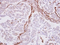 Invitrogen Alpha-Smooth Muscle Actin Polyclonal Antibody 100 &mu;L; Unconjugated:Antibodies,