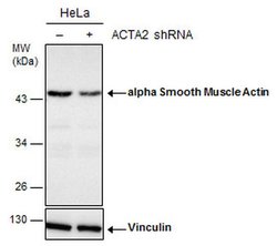 Invitrogen Alpha-Smooth Muscle Actin Polyclonal Antibody 100 &mu;L; Unconjugated:Antibodies,