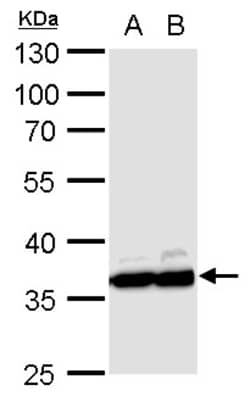 Invitrogen GAPDH Polyclonal Antibody 100 &mu;L; Unconjugated:Antistoffer