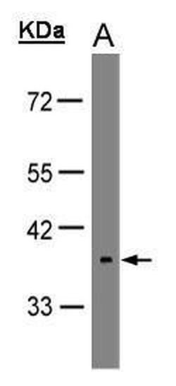 Opsin 5 Polyclonal Antibody, Invitrogen 100 &mu;L; Unconjugated:Antibodies,