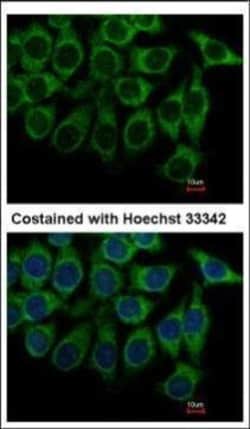 Invitrogen alpha-1a Adrenergic Receptor Polyclonal Antibody 100 &mu;L;