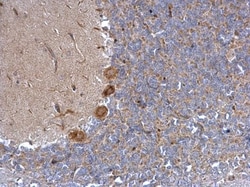 Invitrogen alpha-1a Adrenergic Receptor Polyclonal Antibody 100 &mu;L;