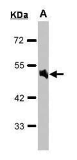 Invitrogen alpha-1a Adrenergic Receptor Polyclonal Antibody 100 &mu;L;