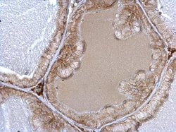 Invitrogen alpha-1a Adrenergic Receptor Polyclonal Antibody 100 &mu;L;