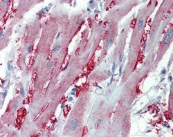 Invitrogen alpha-1a Adrenergic Receptor Polyclonal Antibody 100 &mu;L;