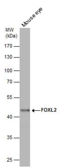 Invitrogen FOXL2 Polyclonal Antibody 100 &mu;L; Unconjugated:Antibodies,