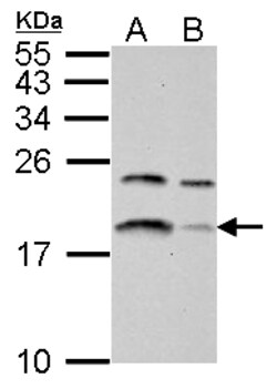 Invitrogen LC3B Polyclonal Antibody 100 &mu;L; Unconjugated:Anticuerpos
