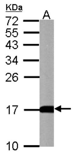 Invitrogen LC3B Polyclonal Antibody 100 &mu;L; Unconjugated:Anticuerpos