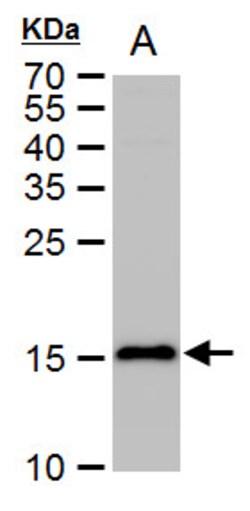 Invitrogen LC3B Polyclonal Antibody 100 &mu;L; Unconjugated:Anticuerpos