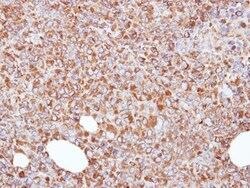 Invitrogen ERp57 Polyclonal Antibody 100 &mu;L; Unconjugated:Antibodies,