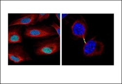 Invitrogen Survivin Polyclonal Antibody 100 &mu;L; Unconjugated:Antibodies,