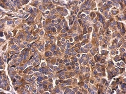 Invitrogen Survivin Polyclonal Antibody 100 &mu;L; Unconjugated:Antibodies,