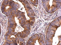 Invitrogen Survivin Polyclonal Antibody 100 &mu;L; Unconjugated:Antibodies,