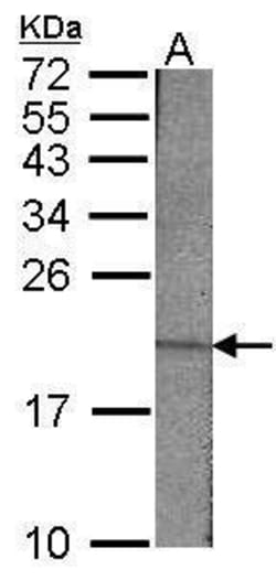 Invitrogen Survivin Polyclonal Antibody 100 &mu;L; Unconjugated:Antibodies,
