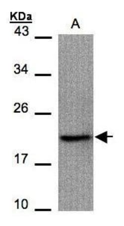Invitrogen Survivin Polyclonal Antibody 100 &mu;L; Unconjugated:Antibodies,