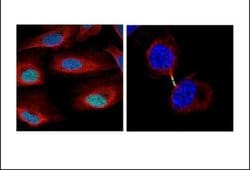 Invitrogen Survivin Polyclonal Antibody 100 &mu;L; Unconjugated:Antibodies,