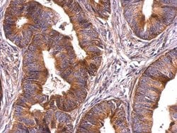 Invitrogen Survivin Polyclonal Antibody 100 &mu;L; Unconjugated:Antibodies,