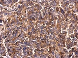 Invitrogen Survivin Polyclonal Antibody 100 &mu;L; Unconjugated:Antibodies,
