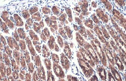 Invitrogen E-cadherin Polyclonal Antibody 100 &mu;L; Unconjugated:Antibodies