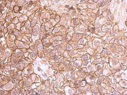 Invitrogen E-cadherin Polyclonal Antibody 100 &mu;L; Unconjugated:Antibodies
