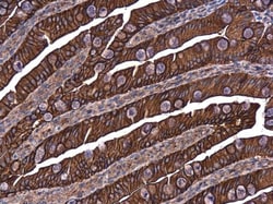Invitrogen E-cadherin Polyclonal Antibody 100 &mu;L; Unconjugated:Antibodies