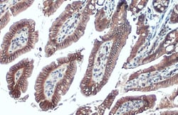 Invitrogen E-cadherin Polyclonal Antibody 100 &mu;L; Unconjugated:Antibodies