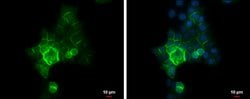 Invitrogen E-cadherin Polyclonal Antibody 100 &mu;L; Unconjugated:Antibodies,