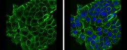 Invitrogen E-cadherin Polyclonal Antibody 100 &mu;L; Unconjugated:Antibodies,