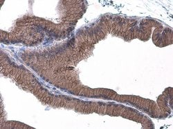 Invitrogen E-cadherin Polyclonal Antibody 100 &mu;L; Unconjugated:Antibodies,