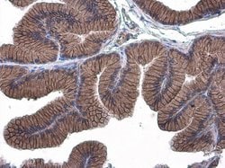 Invitrogen E-cadherin Polyclonal Antibody 100 &mu;L; Unconjugated:Antibodies,