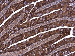 Invitrogen E-cadherin Polyclonal Antibody 100 &mu;L; Unconjugated:Antibodies,