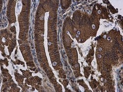 Invitrogen E-cadherin Polyclonal Antibody 100 &mu;L; Unconjugated:Antibodies,