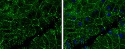 Invitrogen E-cadherin Polyclonal Antibody 100 &mu;L; Unconjugated:Antibodies,
