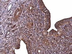 Invitrogen E-cadherin Polyclonal Antibody 100 &mu;L; Unconjugated:Antibodies,