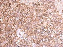 Invitrogen E-cadherin Polyclonal Antibody 100 &mu;L; Unconjugated:Antibodies,