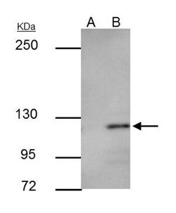 Invitrogen E-cadherin Polyclonal Antibody 100 &mu;L; Unconjugated:Antibodies,